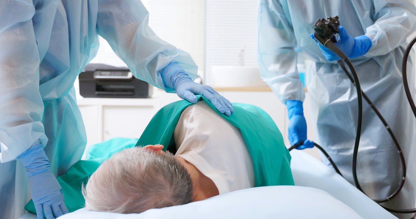 colonoscopy screening